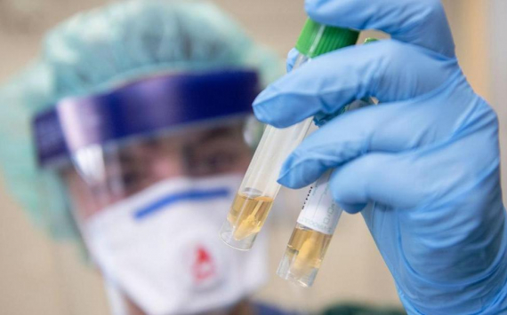 Усс поддержал расширение выплат для медиков, задействованных в борьбе с коронавирусом